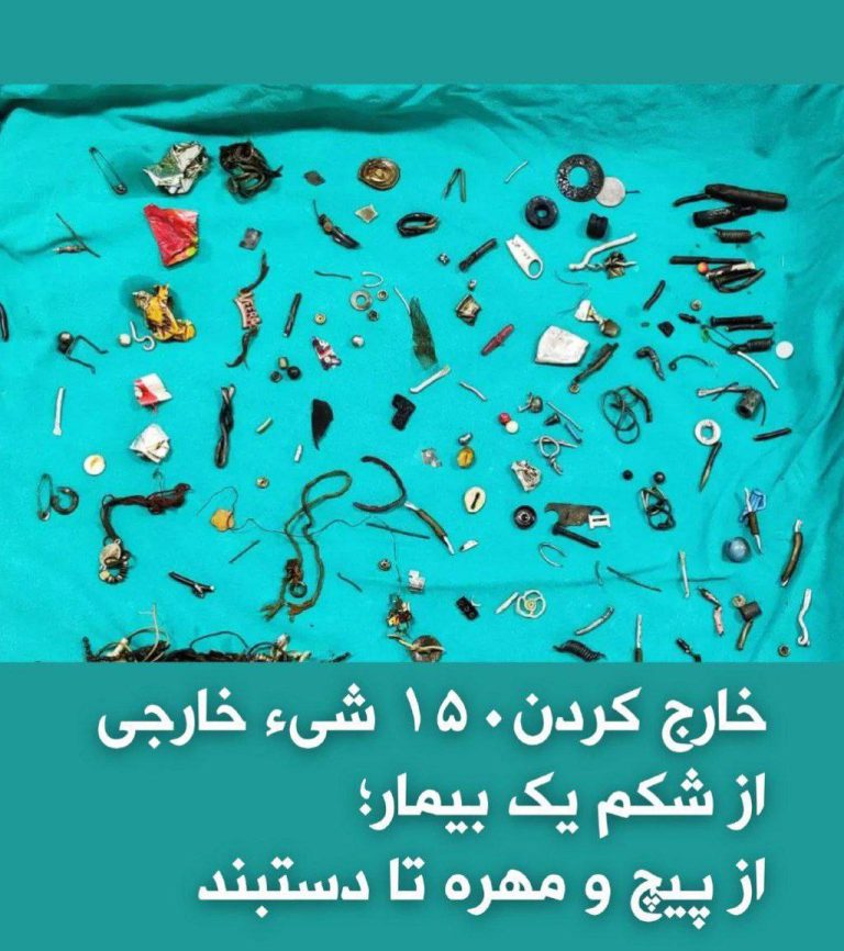 درباره این مقاله بیشتر بخوانید پزشکان ایالت پنجاب هند از طریق انجام عمل جراحی، ۱۵۰ شیء خارجی را از شکم یک مرد ۴۰ ساله خارج کردند. !!!