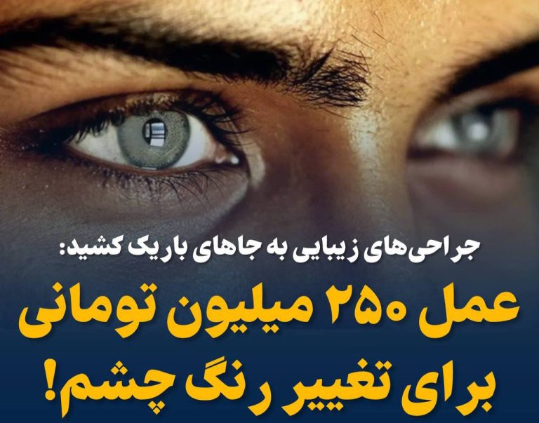 درباره این مقاله بیشتر بخوانید ❗️ جراحی‌های زیبایی به جاهای باریک کشید؛ عمل ۲۵۰ میلیون تومانی برای تغییر رنگ چشم!