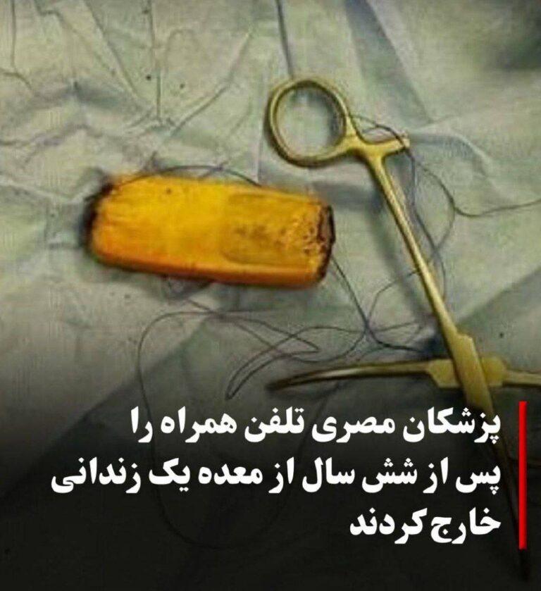 درباره این مقاله بیشتر بخوانید به گزارش میدل‌ایست مانیتور، تیم پزشکان بیمارستان منصوره در مصر توانستند تلفن همراهی را که یک زندانی شش سال پیش بلیعده بود، از معده او خارج کنند!!