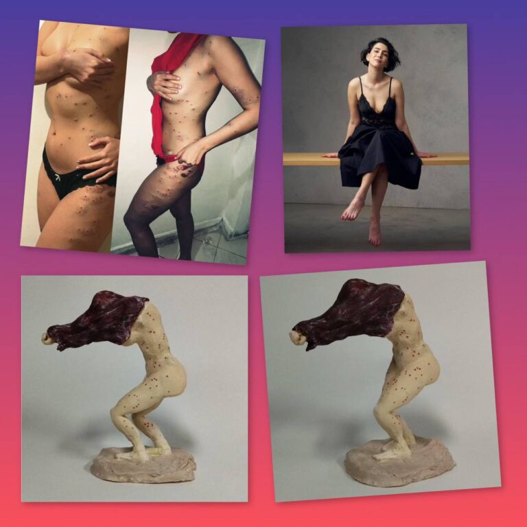 درباره این مقاله بیشتر بخوانید تندیس «زن ساچمه‌خورده»؛ روایتی هنری از جنایت علیه آزادی‌خواهان در جنبش انقلابی «زن، زندگی، آزادی»