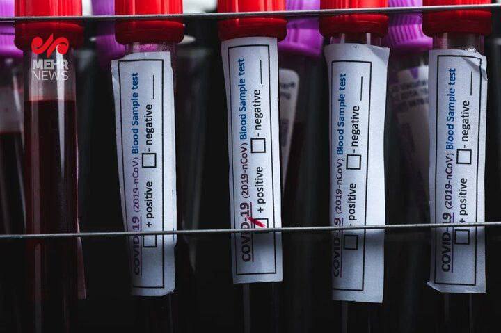 درباره این مقاله بیشتر بخوانید ⚠️به گفته محققان یک ویروس کرونای جدید در چین کشف شده که فاصله اندکی تا جهش یافتن و ایجاد یک همه‌گیری جهانی دیگر دارد❗️